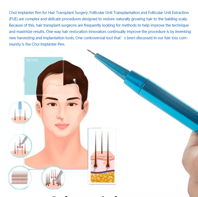 Professional Design Choi Implantor Pen Hair Transplanter Pen Hair Transplant Equipment Instrument For Beauty Salon