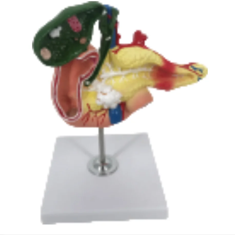 ADA  Pancreas, duodenum spleen models and Pancreatic bile duct pathological model with Pancreatic bile duct pathological model