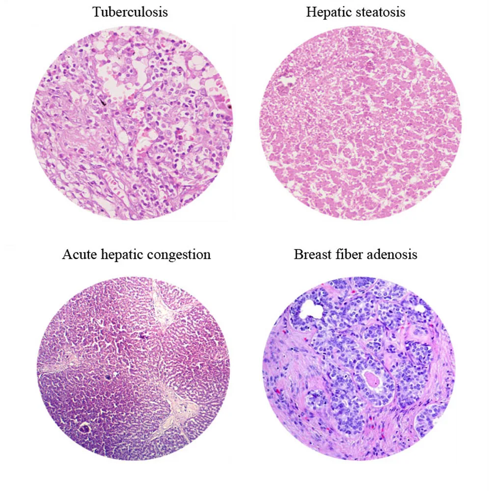 100Pcs Human Disease Pathology Prepared Slides Teaching Prepred Microscope Slides