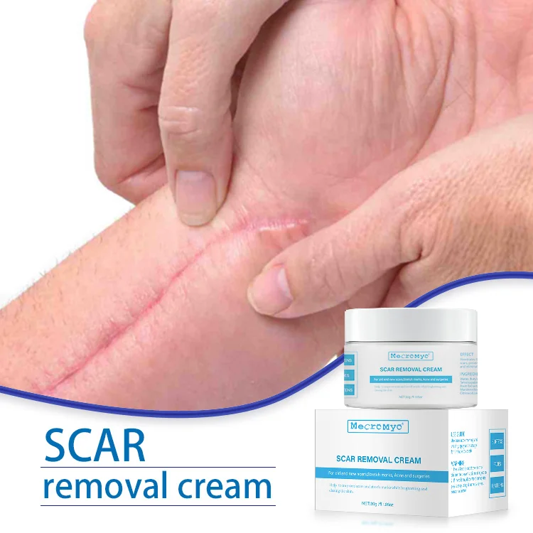OEM/ODM Private Label Old Scar And Dark Spot On Leg Remover Cream Scars And Acne Marks Remove Cream Pregnancy Scars Acne Cream