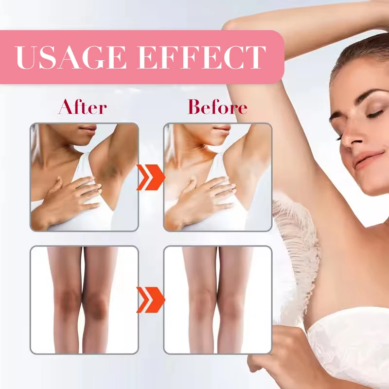 Skin Face And Body Brighten Whitening Cream Snow White Bleach Cream for Private Part Intimate Areas Joint Whitening Cream