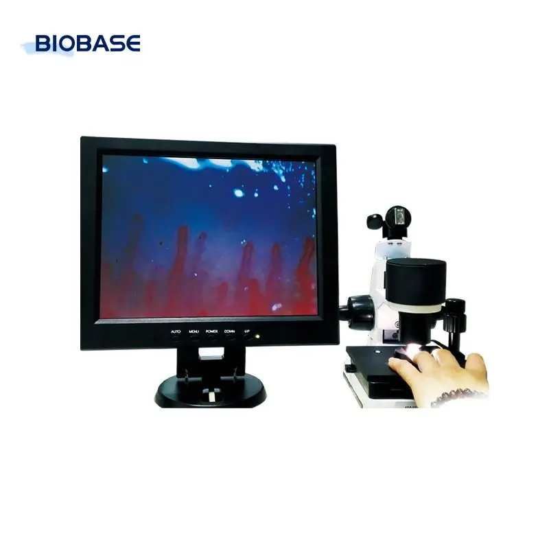 BIOBASE China microcirculation microscope medical camera scanning electron microscope for lab clinic hospital