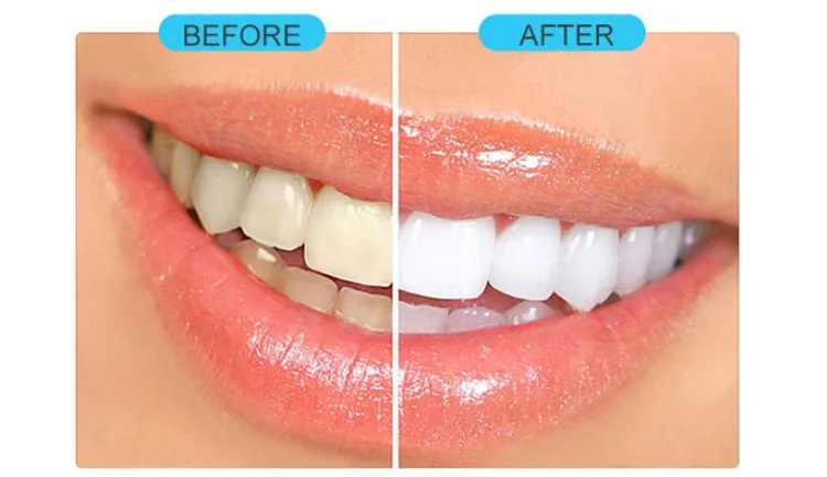 before and afger.jpg