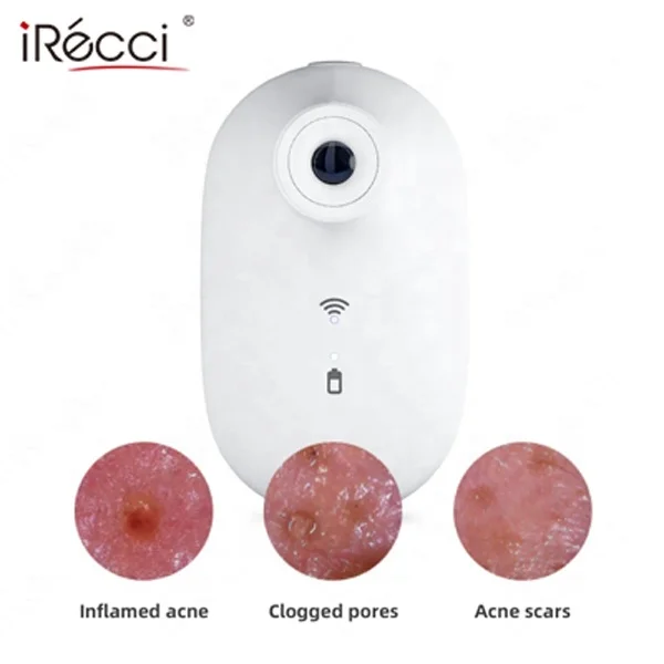 iRecci facial skin pigment scanner analysis device digital face skin dsiagnosis portable handheld skin scanner analyzer for beau