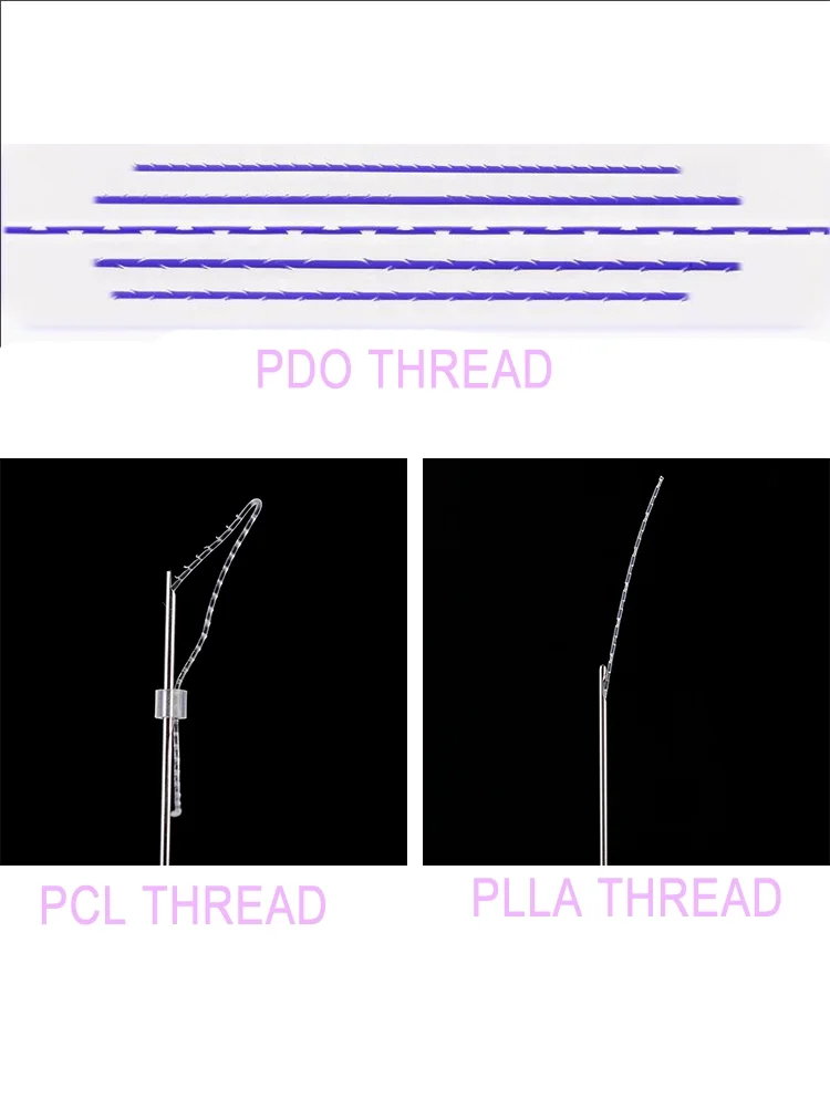 Absorbable bestselling reborn high quality PDO COG Lifting Thread Korea Mono/Screw/Tornado/Cog Thread vline