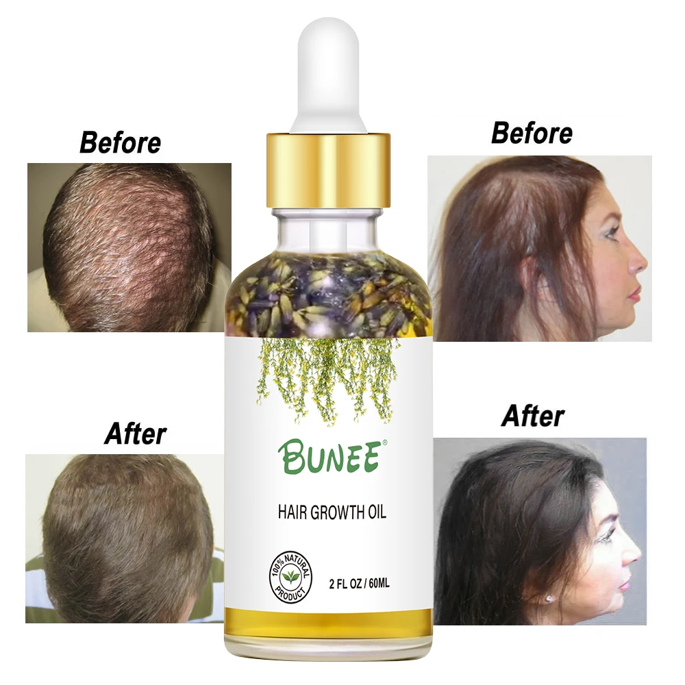 Build Your Own Label Organic Hair Regrowth Treatment Regrowth Serum Anti Hair Loss Lavender Hair Growth Oil
