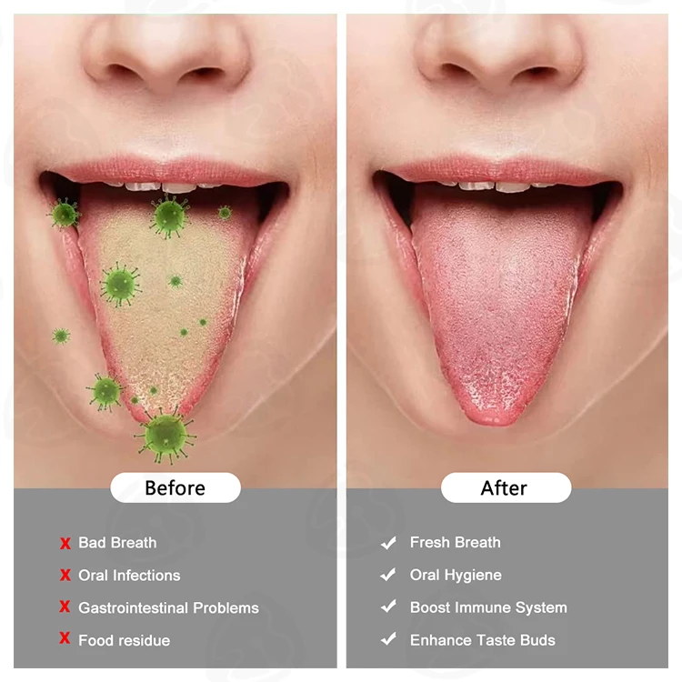 New Clean Up The Mouth Oral Tongue Cleaner Brush Oral Hygiene Care Tools Stainless Steel Copper Tongue Scraper For Adult