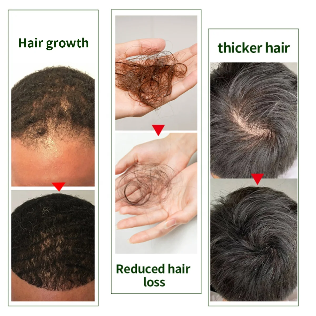 4 In 1 Ginger Ginseng Rosemary Argan Oil Scalp Care Hair Loss Regrowth Growth Oil Serum Bald Treatment For Men Women Ladies
