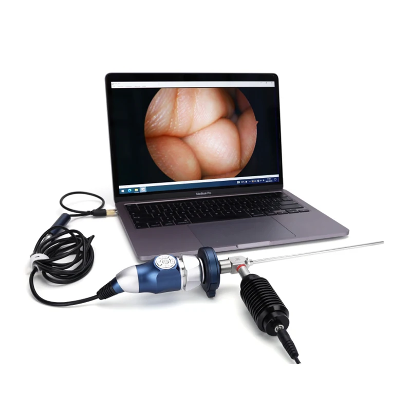 Medical USB video endoscopy camera with recording function