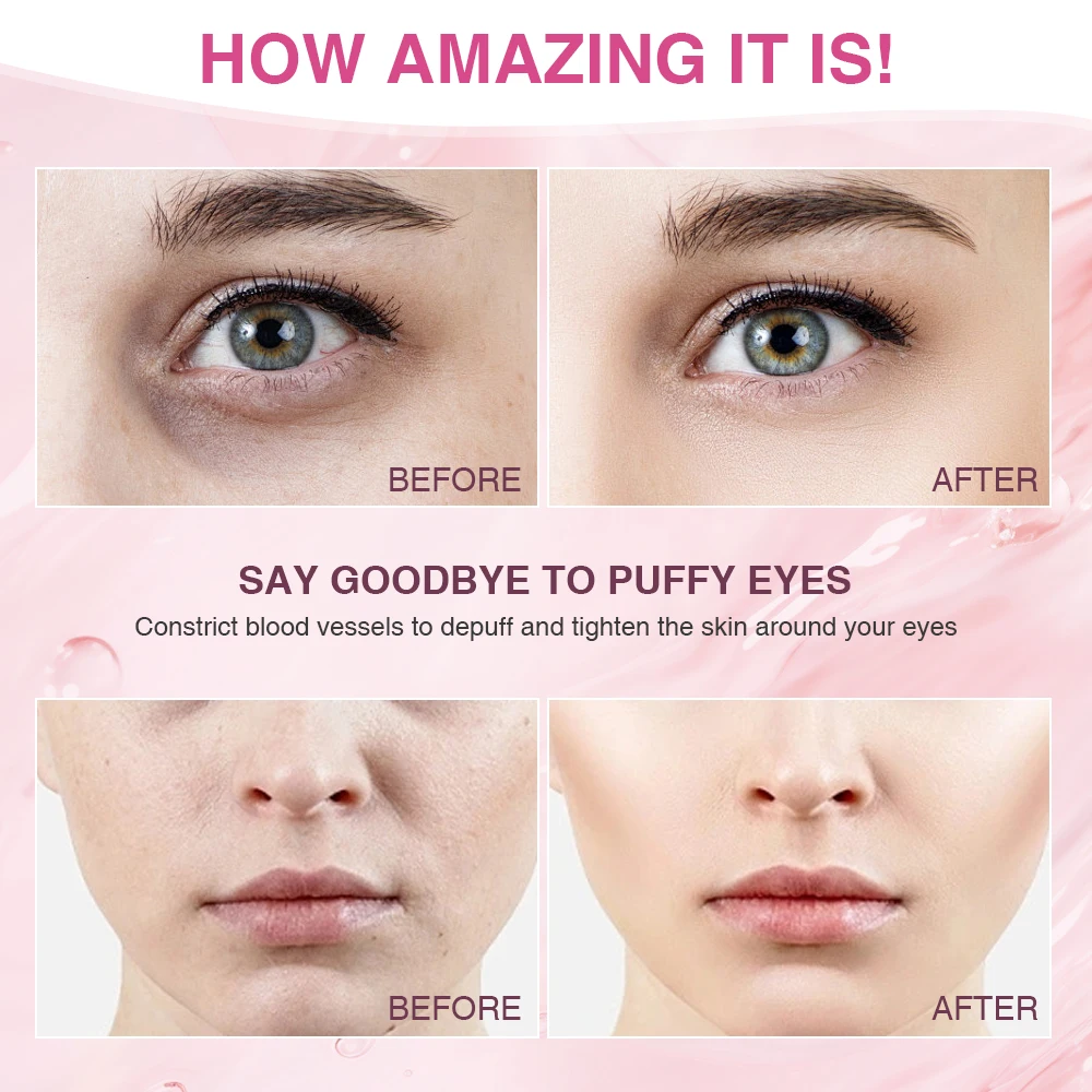 Daily use Aluminum roller skin cooling stainless steel facial body massager ice roller Skin Cooling System 2 In 1 Ice Roller