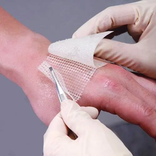 China Roosin Good Quality Paraffin Gauze Medical Dressing For Hospital