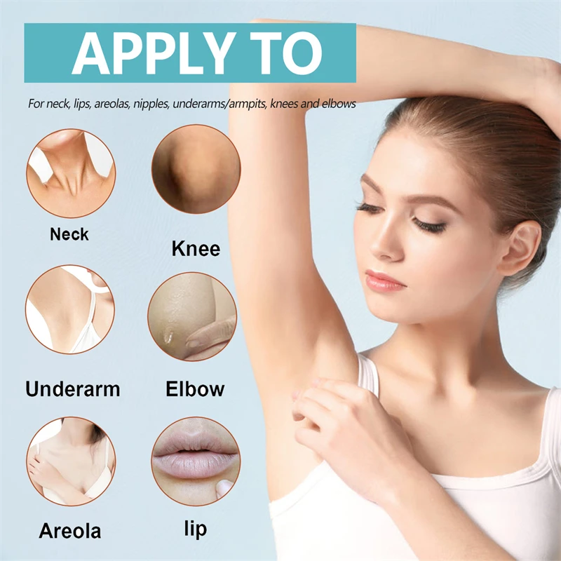 EELHOE 50g acanthosis nigricans therapy cream nape elbow knees knuckles back moisturizing brightening exfoliating cream
