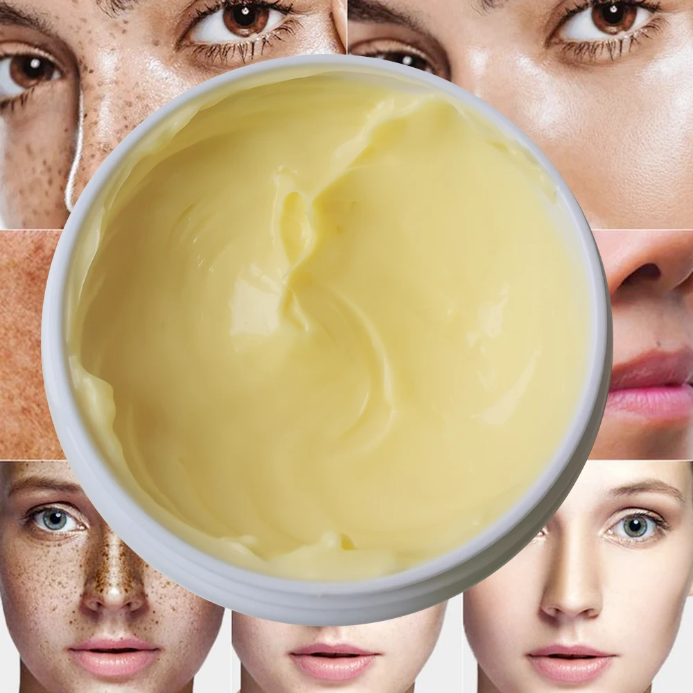 Spot Remover Anti Aging Skin Care Brightening Acne Removing Turmeric Moisturizing Face Cream Black Private Label Day Guangdong