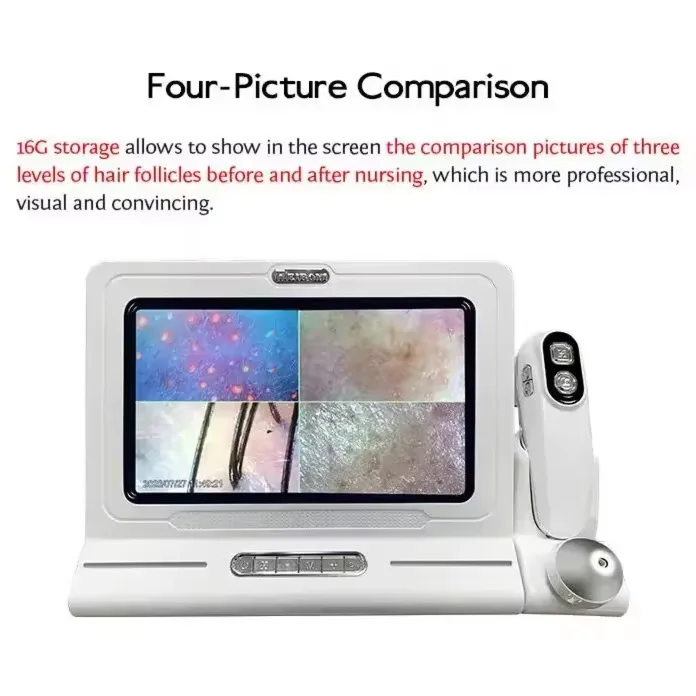 New Designed Professional four-spectrum hair follicle scalp skin analysis detector HD large screen 200 times beauty salon