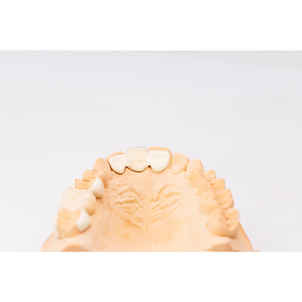 dental laboratory denture teeth fixed crown artificial tooth PEEK Composite Crown for dental clinic