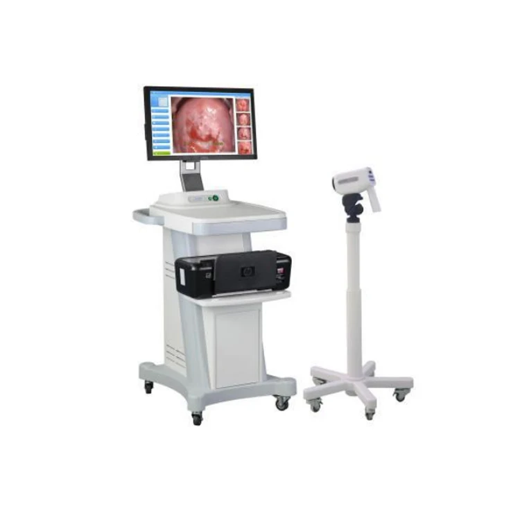 A-Faith Portable 3000E Gynecological Digital Video Colposcope with Image Freeze Control