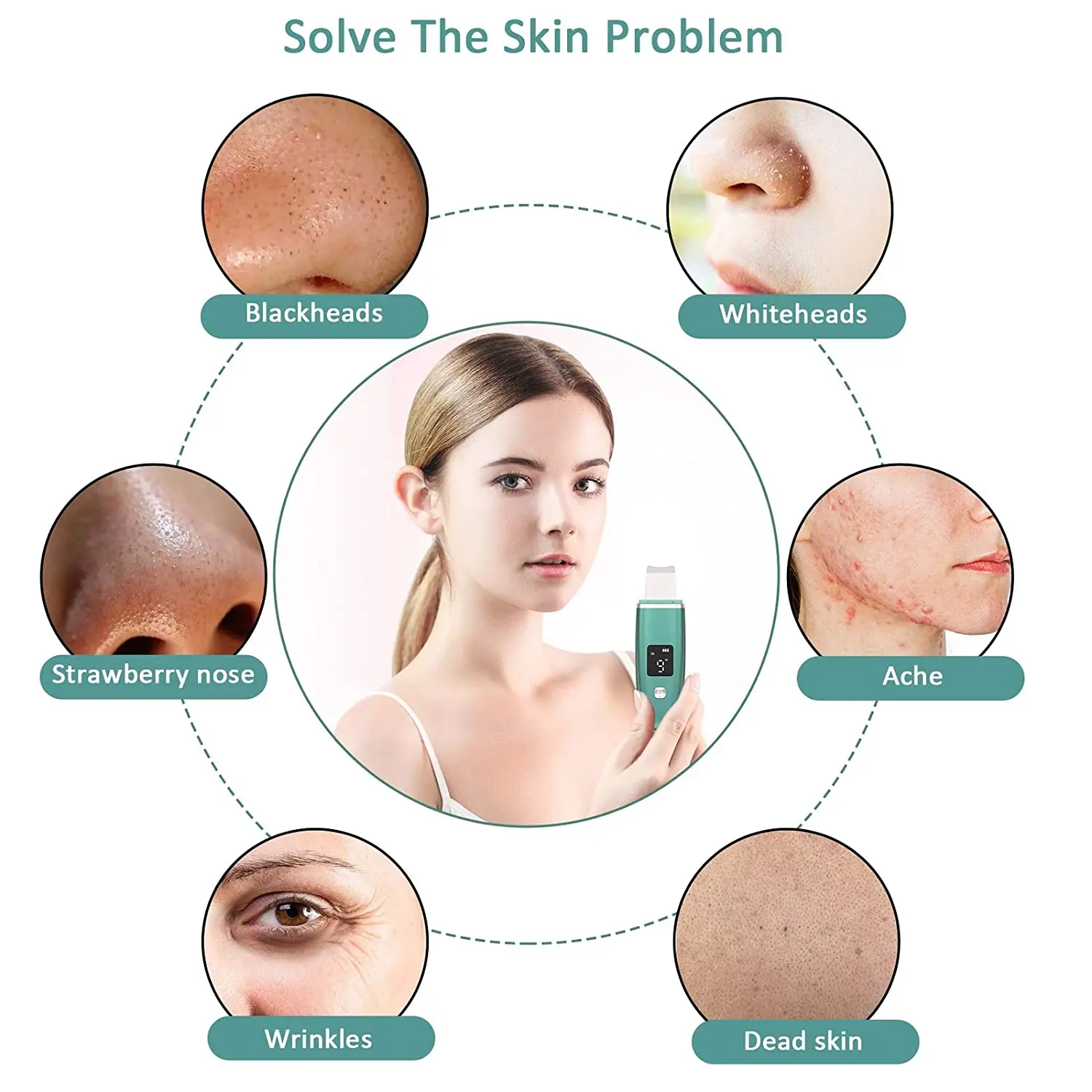 2022 Aifree Facial Pore Cleaning Spatula Sonic Blackhead Remover Face Ultrasonic Skin Scrubber