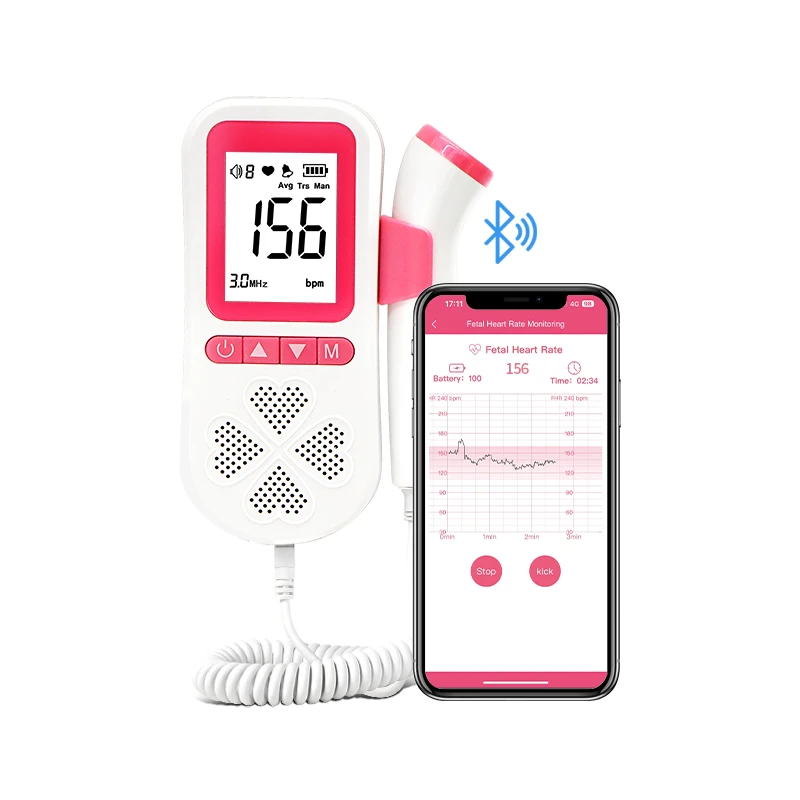 Remote Telehealth Record and Share Baby Heartbeat Monitor Fetal Doppler with App Mobile Phone Bluetooth Connect