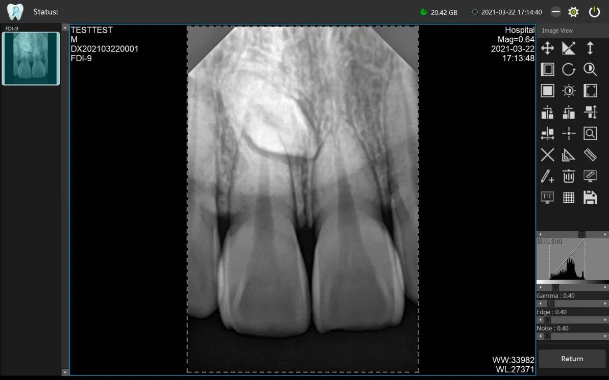 Iray Portable RVG Dental Sensor Woodpecker RVG Sensor Dental for Digital Dental X-RAY MSLFP35