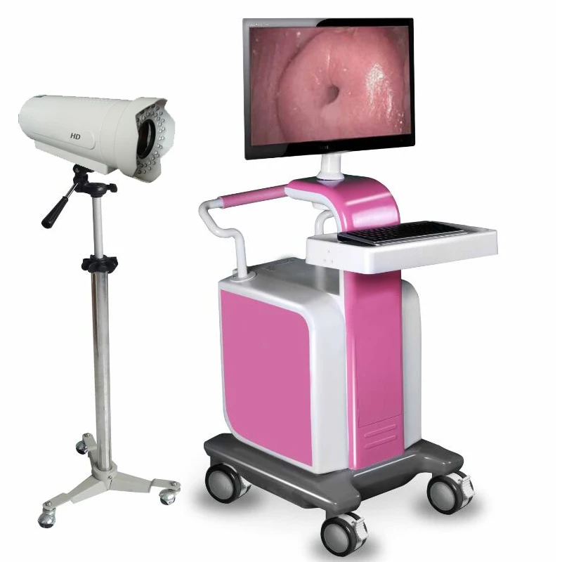 
Passed colposcopy machine digital video colposcope for gynecology examination 