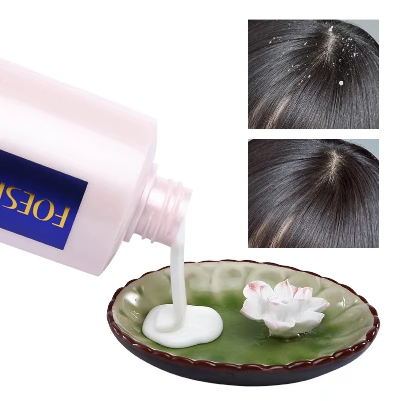 Custom Logo Sulphate Free Hair Care Shampoo For Dry Frizzy Hair Deep Repare For Oil Hair Shampoo