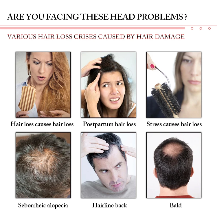 Maquinas De Estetica Doeid Laser Max 650NM Crecimiento Cabello Treatment Care Equipment Hair Growth Led Machine