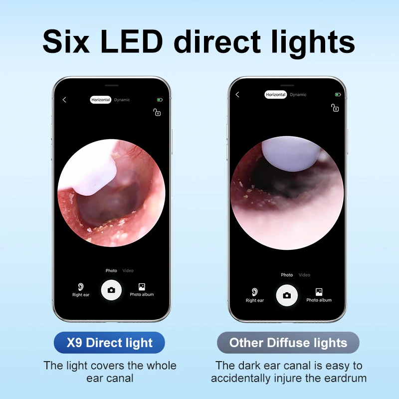 X9 5MP HD Pixels Camera Hot Sell Earwax Cleaning Otoscope Endoscope Camera for Mobile Phone