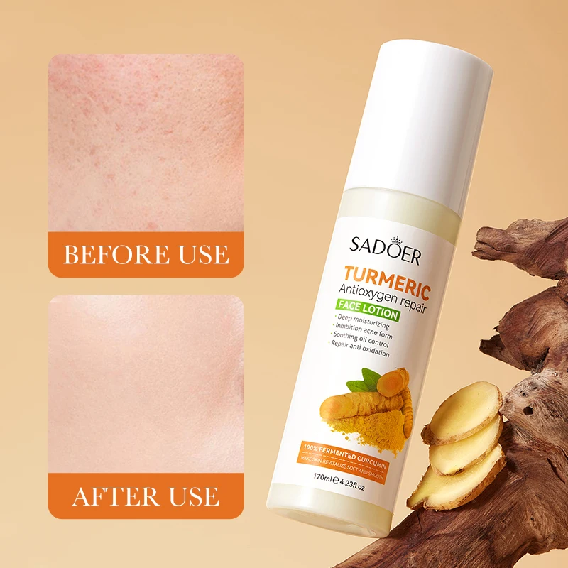 SADOER Wholesale Face Lotion Turmeric Anti-Acne Moisturizing Brightening Repair Smooth Skin Care Facial Milk Cosmetic Products
