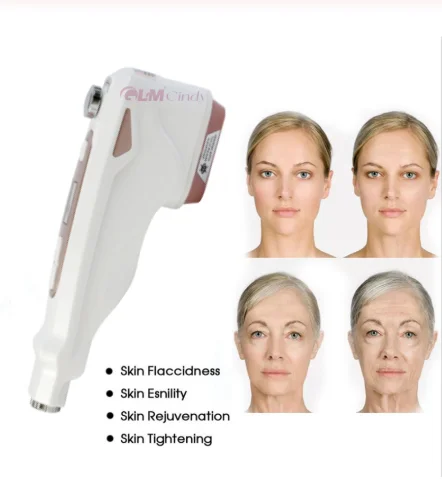 Non Surgical Facial Lifting Skin Firmness Eye Neck Forehead Wrinkles Removal Anti aging Hiifu Machine