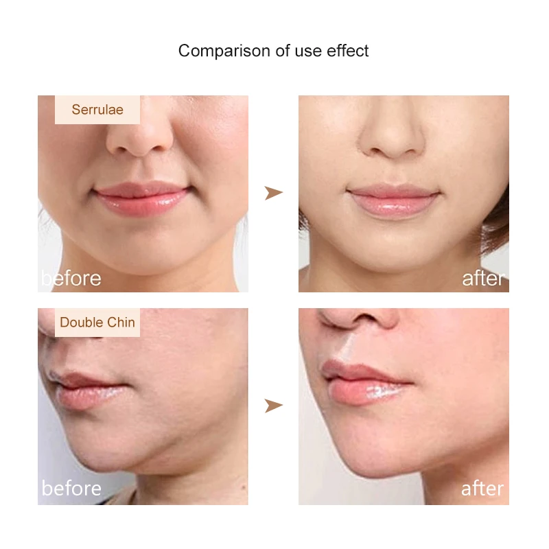 Anti Wrinkle Slim Face Mesh Fabric Slimming Lifting Belt V-line Chin Cheek Lift Up Band Bandage