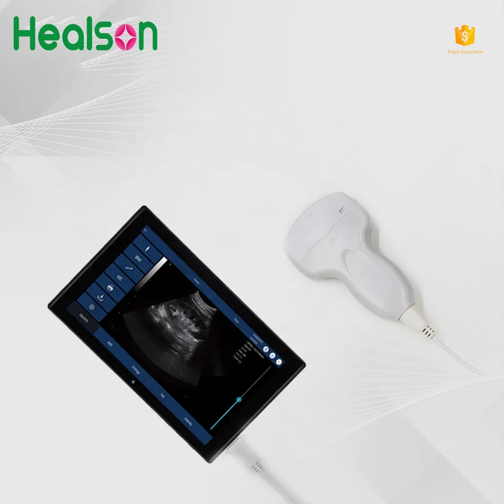 
Healson UP20 cheapest USB portable ultrasound machine /usb ultrasound probe 