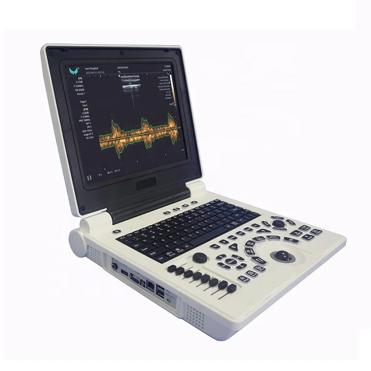 Ultrasound machine M216 laptop ultrasound scanner  with PW function price ultrasound scanner