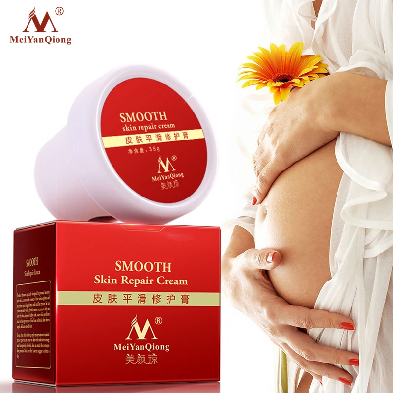 Body Skin Care stretch marks scar removal cream Maternity treatment Anti Vergeture Repair Stretch Mark Cream