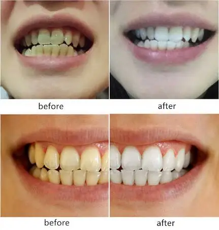 Teeth Whitening Water Oral Hygiene Cleaning Yellow Teeth Tartar Smoke Stains Tea Stains Tooth Stones Mouth Bitter Bad Breath oem