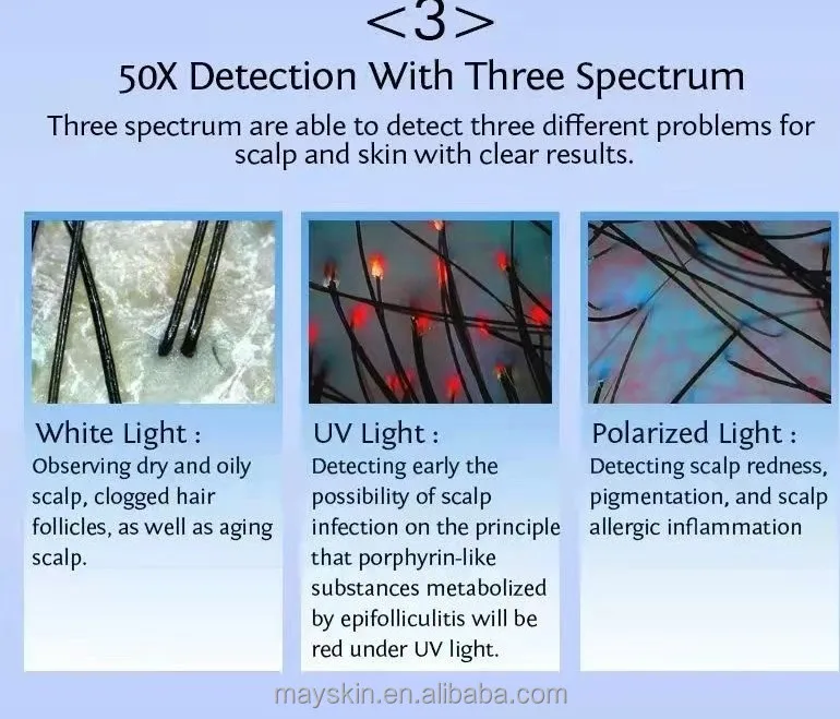 1080p high resolution 11 inch skin analyzer Hair follicle detector Hair analyzer head therapy special instrument