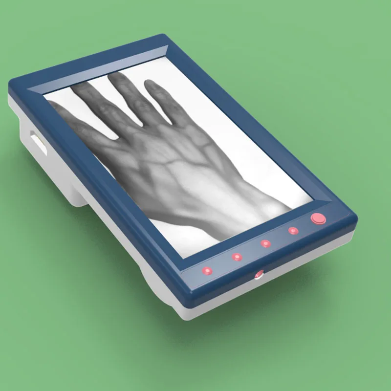 
Medical Vascular Imaging Instrument with LCD Display Vein Finder Vein Viewer 