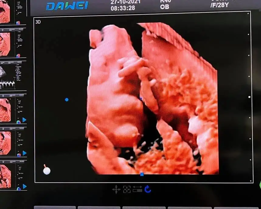 Dawei Brand DW-P50 4D/5D portable color doppler ultrasound machine system with High Quality