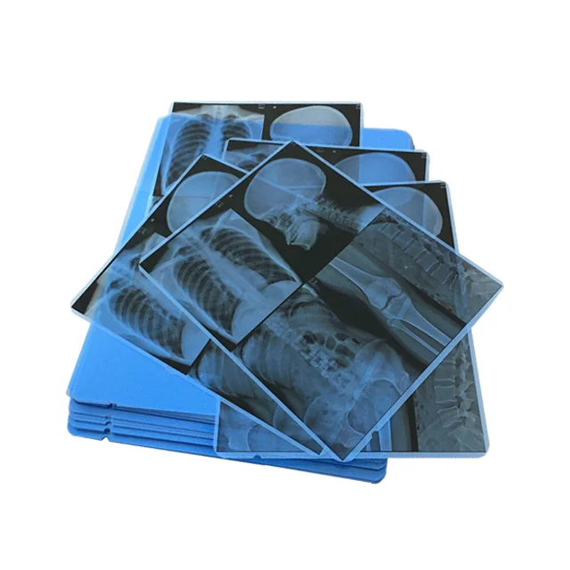 Waterproof High Speed 150mic 8 10 Inch Blue Medical Inkjet XRay Clear Transparent Film