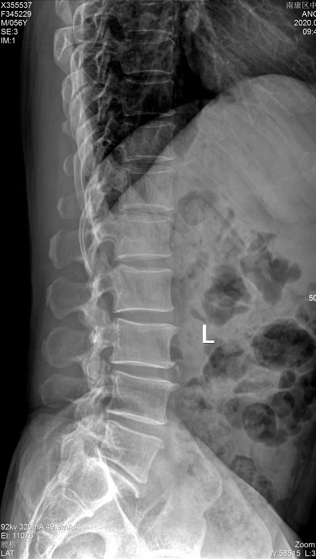 Konida medical dry film , agfa dt2b xray camera