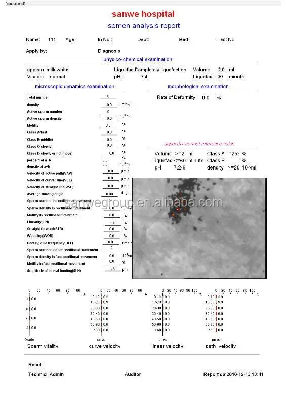 Auto Lab Semen Analyzer / CASA Software / SW-3702 Computer Aided Sperm Analyzer