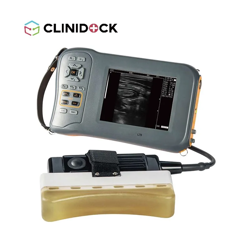 Digital Veterinary Ultrasound Diagnostic System
