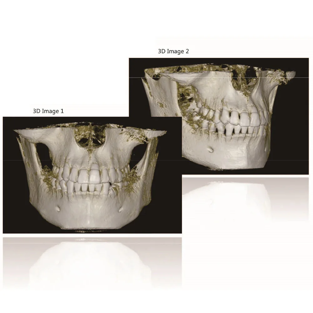 Для использования в медицине, radiographie dentaire, 2D 3D CBCT зубоврачебный панорамный рентгеновский сканер машина цена