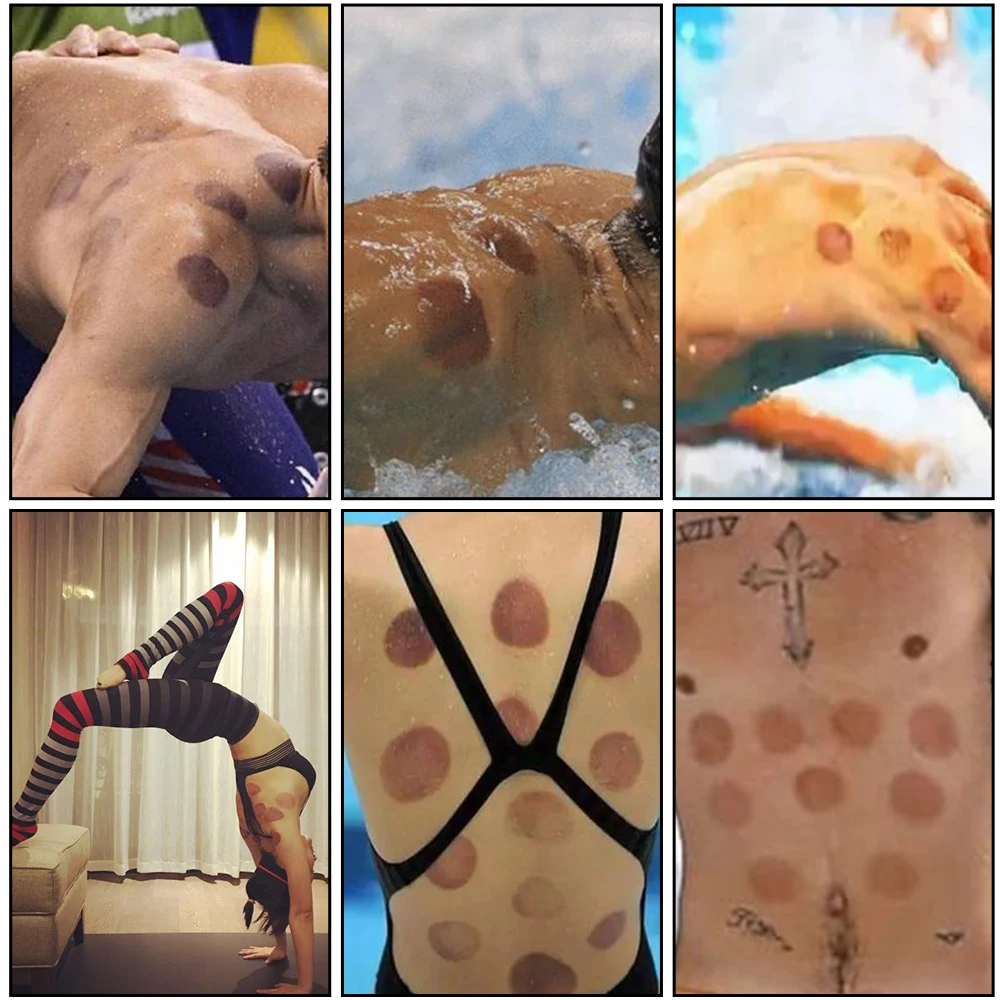 PZ Vacuum Therapy Medical Cupping Devices Suction Ventouse Cupping Machine Hijama Plastic Ce OEM 7 Piece Cupping Set 24pcs