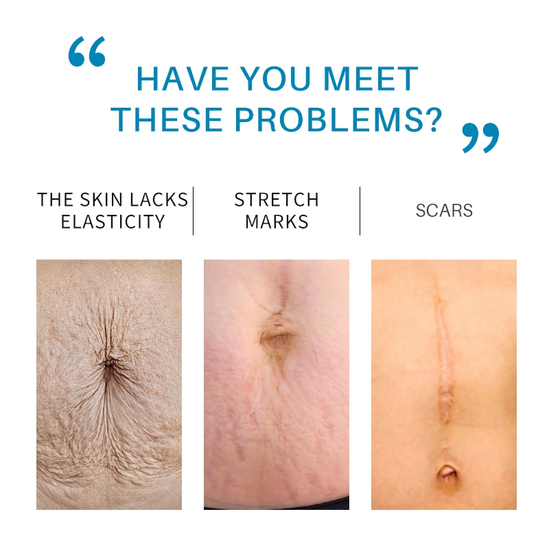 LANTHOME private label hydrating anti-aging skin care Hyaluronic acid vitamin e  face serum