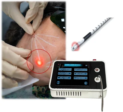 Dual Wavelength Portable 980nm 1470nm Diode Laser Lipolysis and Lipid-lowering Vaser Optical Fiber Endolaser Face Lifting