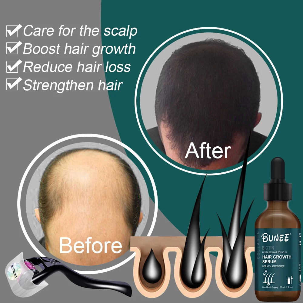 Free Sample Fast Effective Hair Growth Oil help hair regrowth set for black women