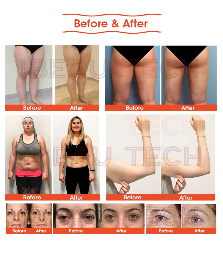 Kim 8 Slimming System Starvac S shape Vacuum Lipo 80k RF Cavitation Slimming Slim Liposuction Machine For Fat Loss