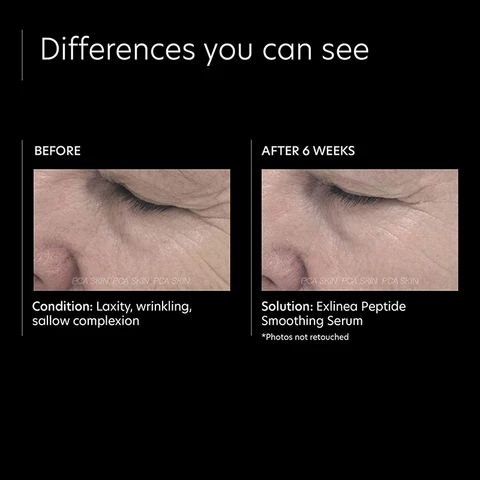 Private Label Organic Sensitive Skin Care Anti Aging Peptide Hyaluronic Acid Facial Hydrates Smooths Firms Skin Serum