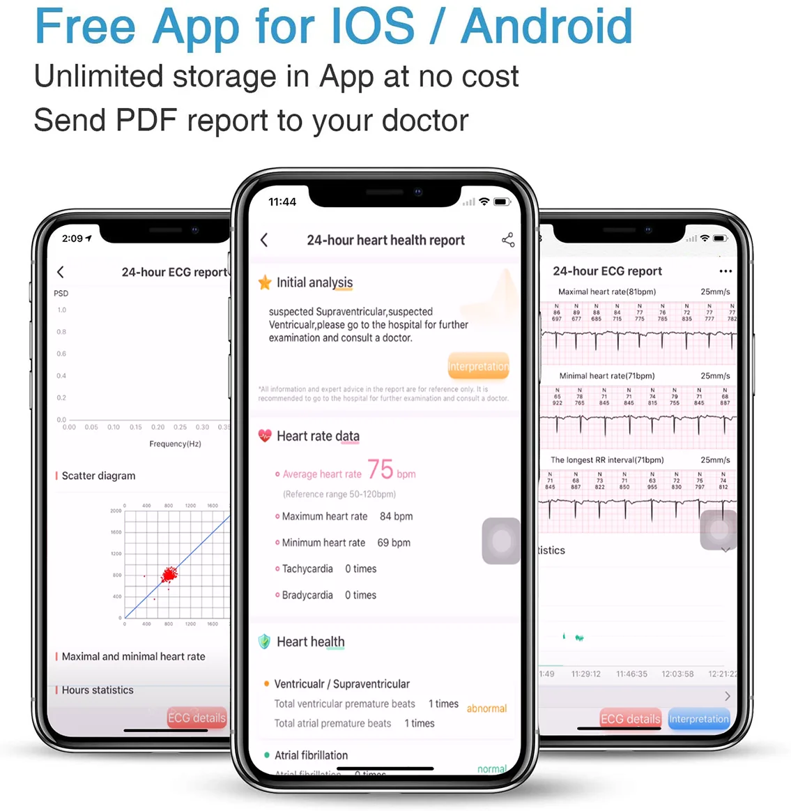 24hr smarteatch reusable electrocardiograph bluetooth ecg monitor portable ecg