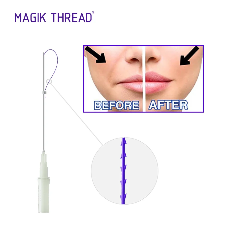 Magik Thread korea wholesale samyang pdo thread L cannula blunt fishbone pdo cog thread lift